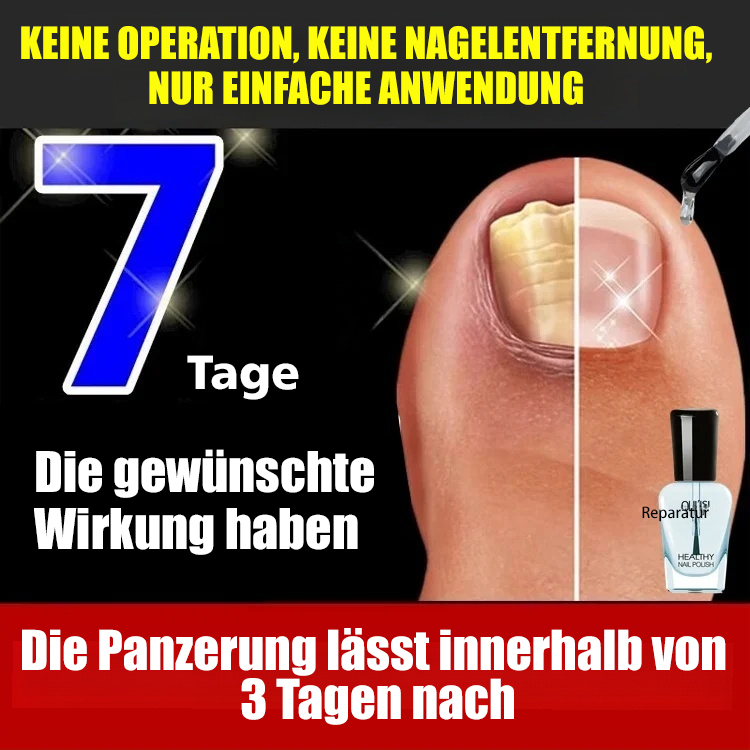 Nagelwachstum-Reparatur-Lotion