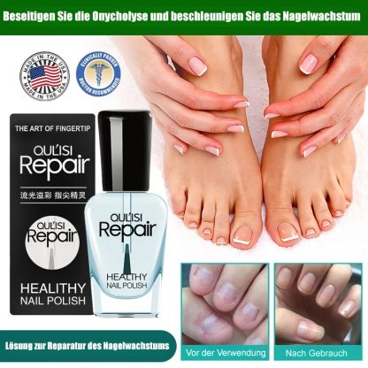 Nagelwachstum-Reparatur-Lotion