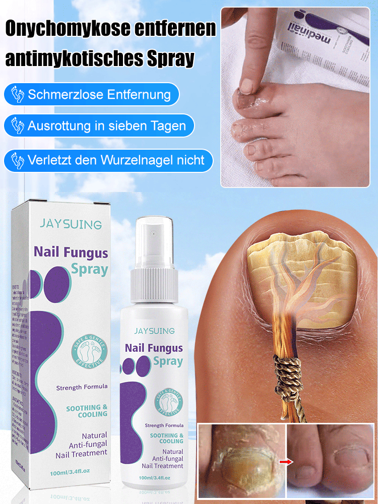 Anti-Pilz-Spray für graue Nägel