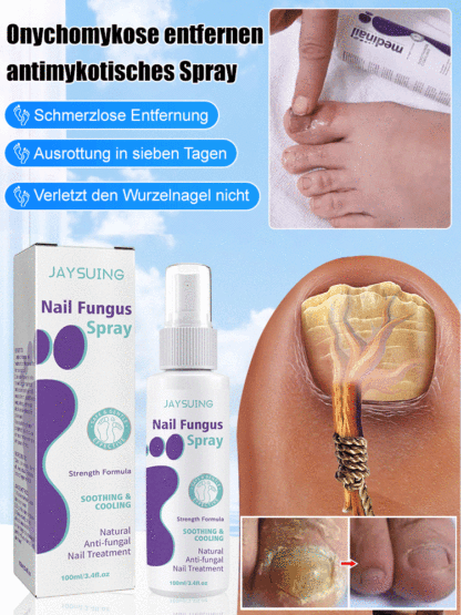 Anti-Pilz-Spray für graue Nägel