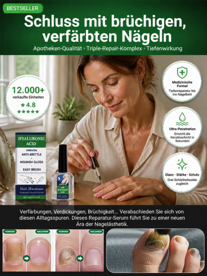 💅 Medizinisches Hyaluronsäure Nagelhärter Serum – Japans Nr.1 Formel gegen brüchige Nägel, Heute 50% Rabatt mit risikofreier 30-Tage-Geld-zurück-Garantie