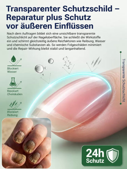 💅 Medizinisches Hyaluronsäure Nagelhärter Serum – Japans Nr.1 Formel gegen brüchige Nägel, Heute 50% Rabatt mit risikofreier 30-Tage-Geld-zurück-Garantie