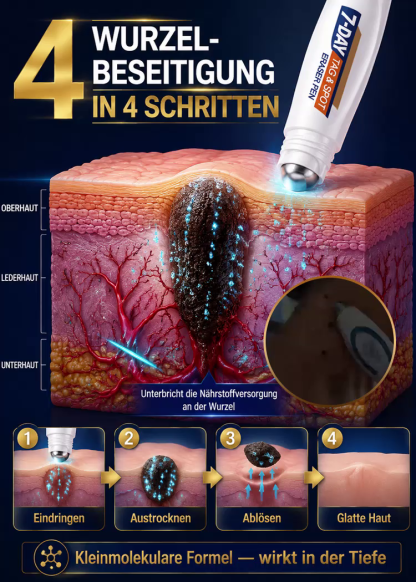 【7 Tage schmerzfreie Warzenentfernung】🌿 Dermatologisch Getesteter Sanfter Hautpflege Stift – Ausgestattet mit einer 1,5 mm Präzisions-Rollkugel aus Edelstahl für sichtbar glattere Haut – Sichern Sie sich heute 50 % Rabatt + 30 Tage kostenlose Testphase