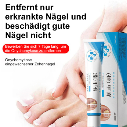 [Schmerzlos und kein Wiederauftreten] Onychomykosesalbe
