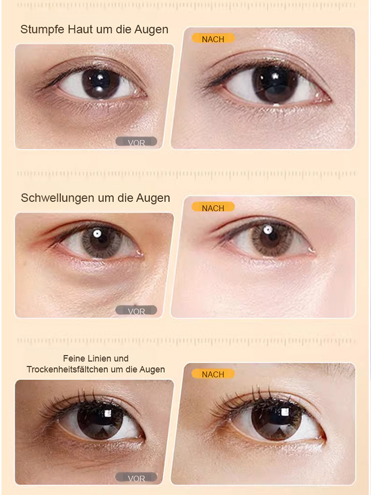 Eye SPA Lutein Firming Essence Oil – Strafft, hellt auf, spendet Feuchtigkeit und mildert feine Linien