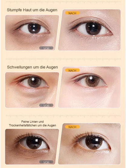 Eye SPA Lutein Firming Essence Oil – Strafft, hellt auf, spendet Feuchtigkeit und mildert feine Linien