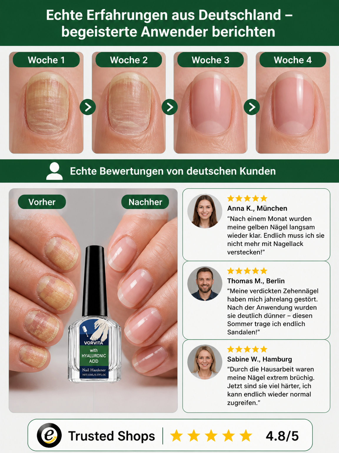 💅 Medizinisches Hyaluronsäure Nagelhärter Serum – Japans Nr.1 Formel gegen brüchige Nägel, Heute 50% Rabatt mit risikofreier 30-Tage-Geld-zurück-Garantie