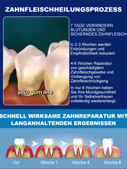 ✨Die ultimative Lösung für empfindliches Zahnfleisch: 🧴Zahnregenerierendes und reparierendes Gel! 🌿Formuliert mit natürlichen Pflanzenextrakten, 🩹repariert es zurückgehendes Zahnfleisch, 🛡️stärkt den Zahnschmelz und sorgt so für stärkere Zähne in nur 