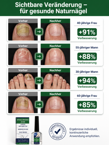 💅 Medizinisches Hyaluronsäure Nagelhärter Serum – Japans Nr.1 Formel gegen brüchige Nägel, Heute 50% Rabatt mit risikofreier 30-Tage-Geld-zurück-Garantie