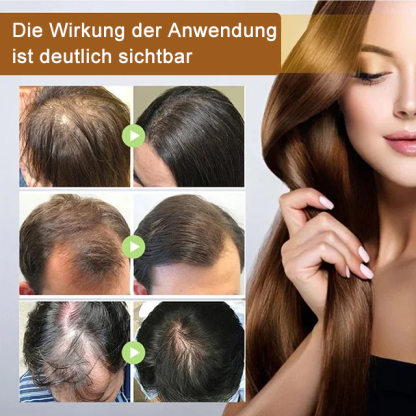 Biotin-Haarwachstumsspray