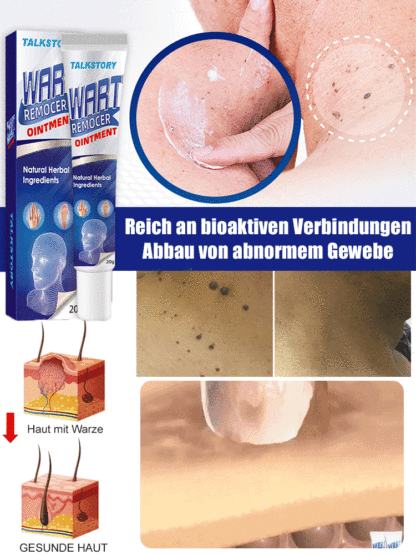 Creme zur Warzenentfernung