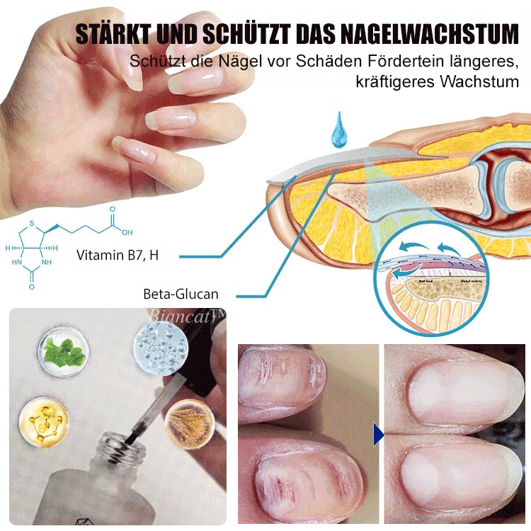 Nagelwachstum-Reparatur-Lotion