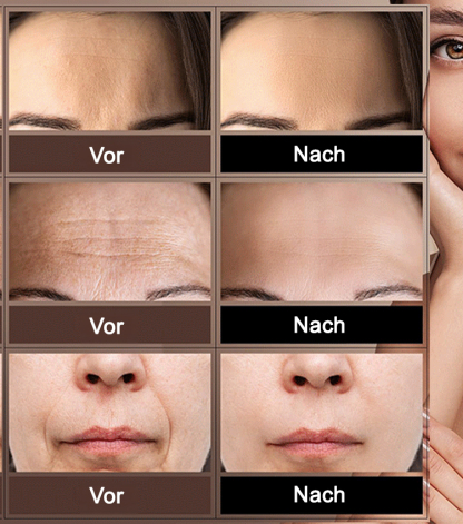 [Line Smoothing Touch] Straffendes Anti-Falten- und Anti-Aging-Serum