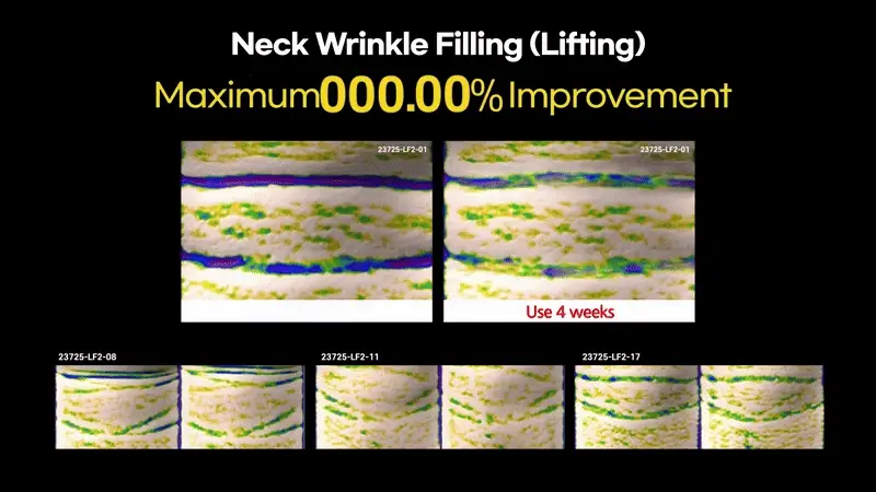 necksphlt 01 1 0903
