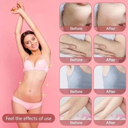 🏆Only £12.99 Last Day Promotion!🎁Comfort 2 in 1 Electric Lady Shaver