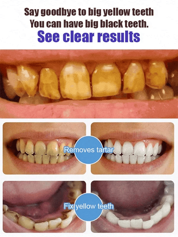 ⏰Super Probiotic-6 Toothpaste with 6 Probiotics oalance Oral microbiota strength-SLOOSELYK