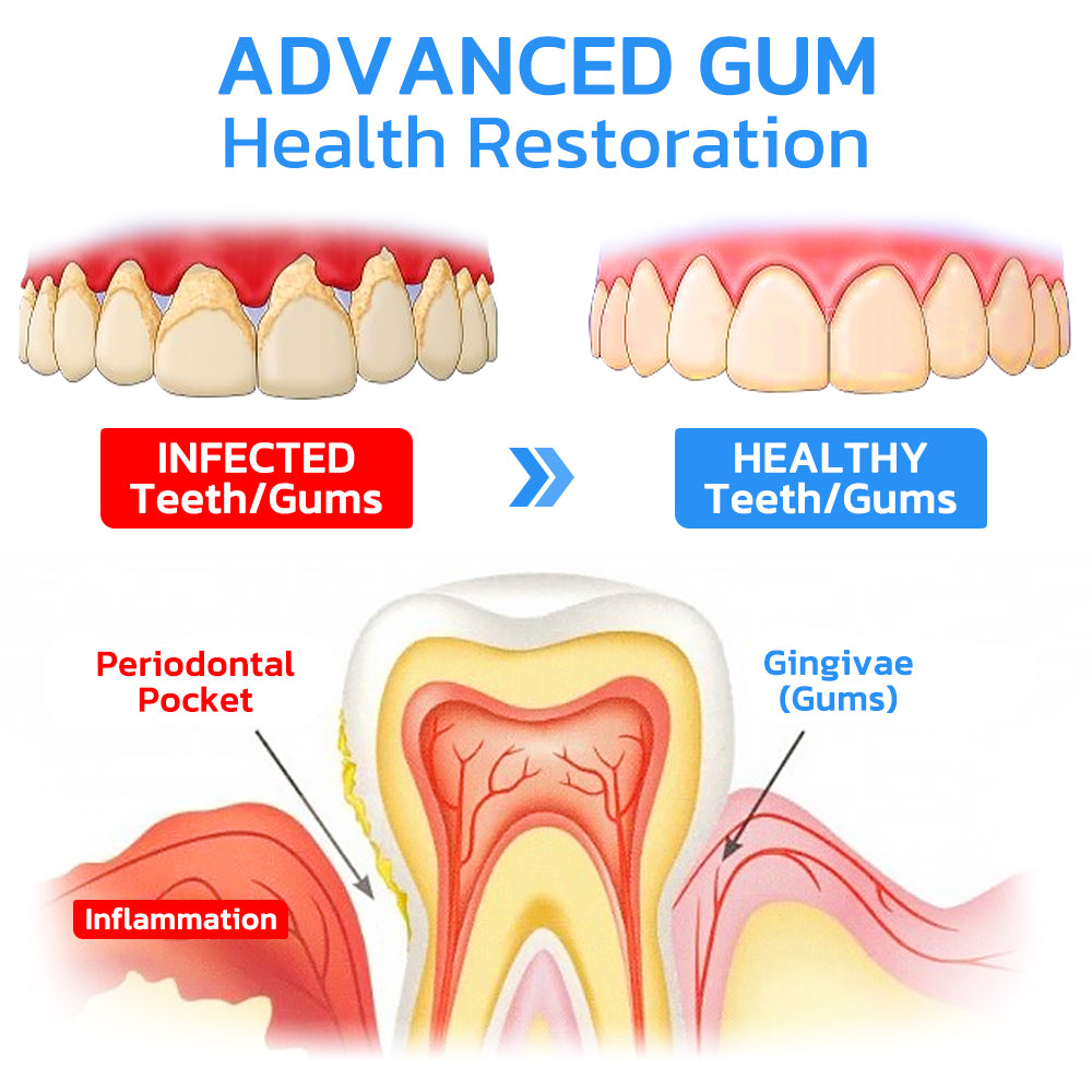 ✨✨✨LAST DAY PROMOTION - 50% OFF💜Gum care gel