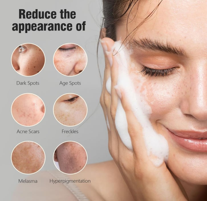 ❤️HOT SALE❤️Kojic Acid Dark Spot Remover Soap-SLOOSELYK