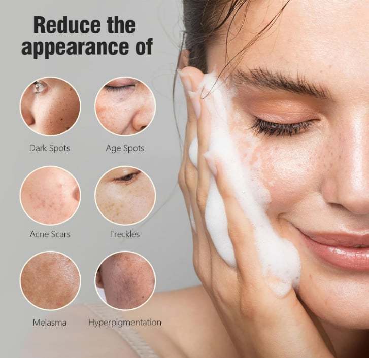 ❤️HOT SALE❤️Kojic Acid Dark Spot Remover Soap-SLOOSELYK