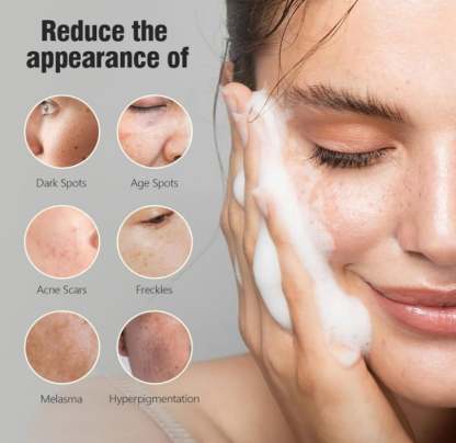 ❤️HOT SALE❤️Kojic Acid Dark Spot Remover Soap-SLOOSELYK