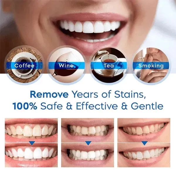 Teeth Whitening Essence🔥Buy 1Get 1 Free🔥