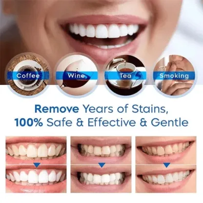 Teeth Whitening Essence🔥Buy 1Get 1 Free🔥