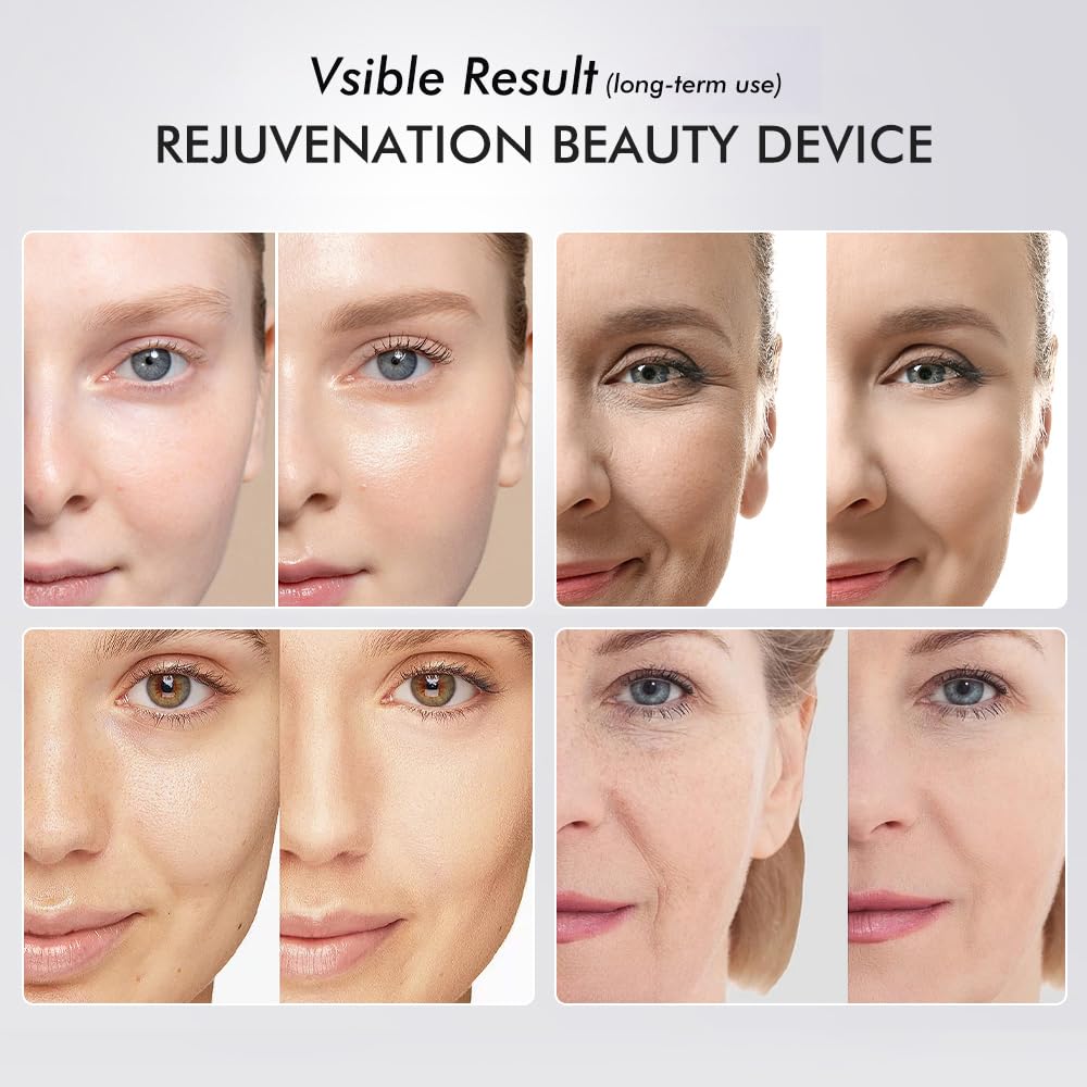 Nutrofuels™ 6-in-1 Facial Rejuvenator – LED & Microcurrent Lifting for Firmer, Brighter Skin