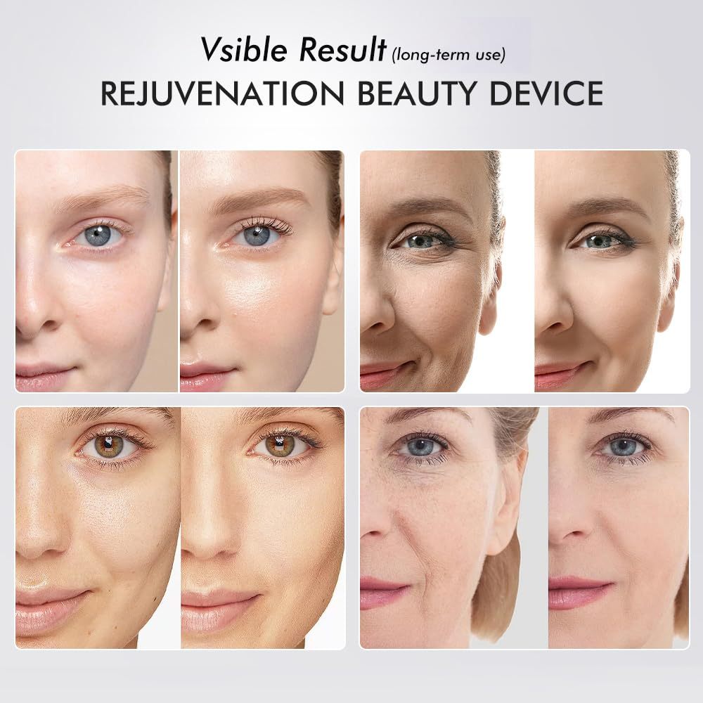 Nutrofuels™ 6-in-1 Facial Rejuvenator – LED & Microcurrent Lifting for Firmer, Brighter Skin