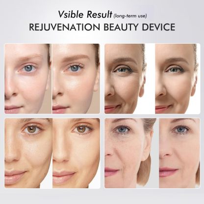 Nutrofuels™ 6-in-1 Facial Rejuvenator – LED & Microcurrent Lifting for Firmer, Brighter Skin