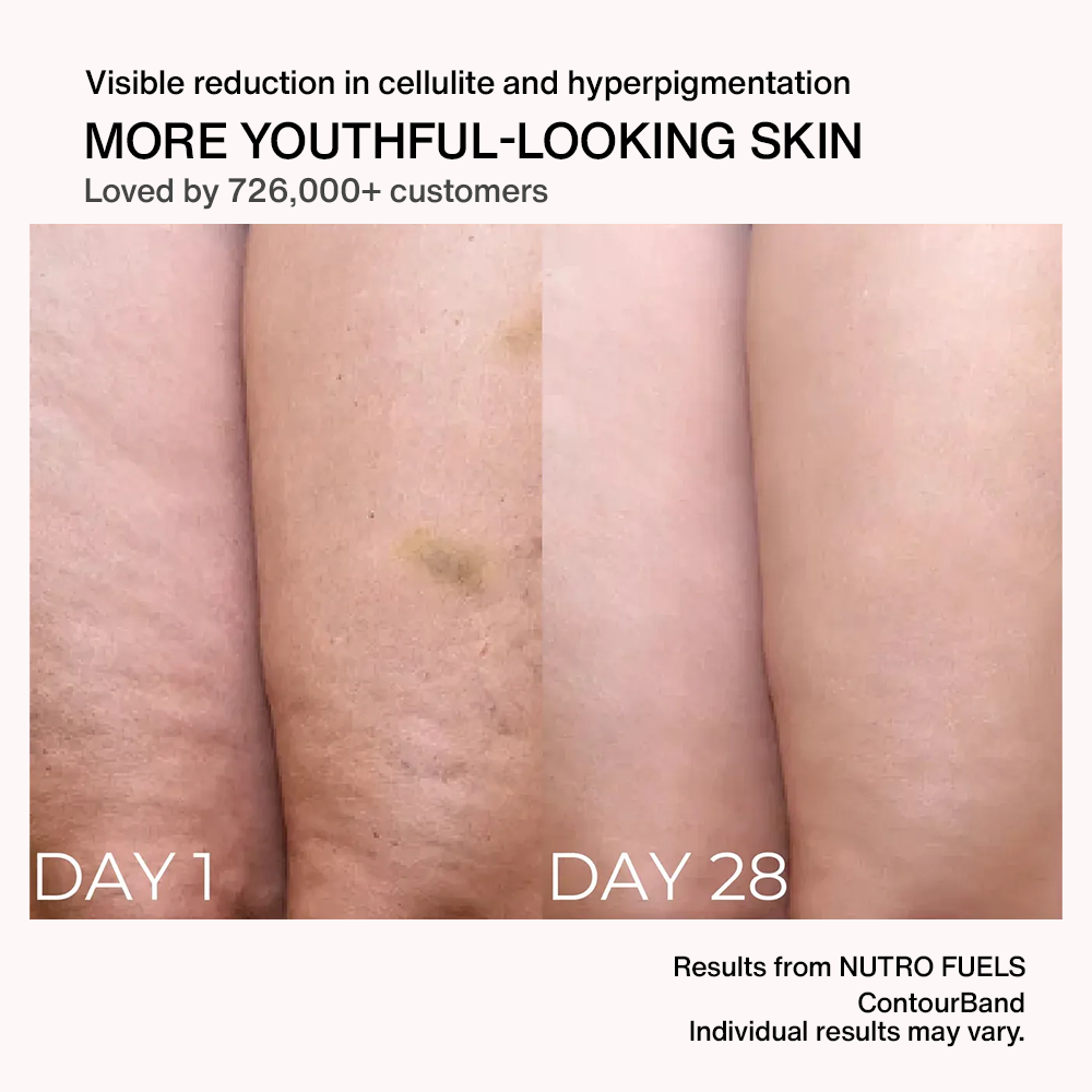 Nutrofuels™ Contour Band – Sculpt Arms & Thighs, Smooth Cellulite, Firm Skin