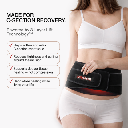Red Light Therapy Belt for C-Section Scar Healing