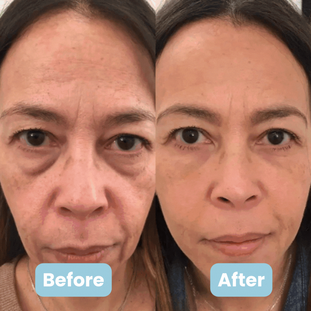 Nutrofuels™ 3-in-1 LED Face Sculpting Wand – Red, Blue & Green Light for Lifting, Anti-Aging & Acne