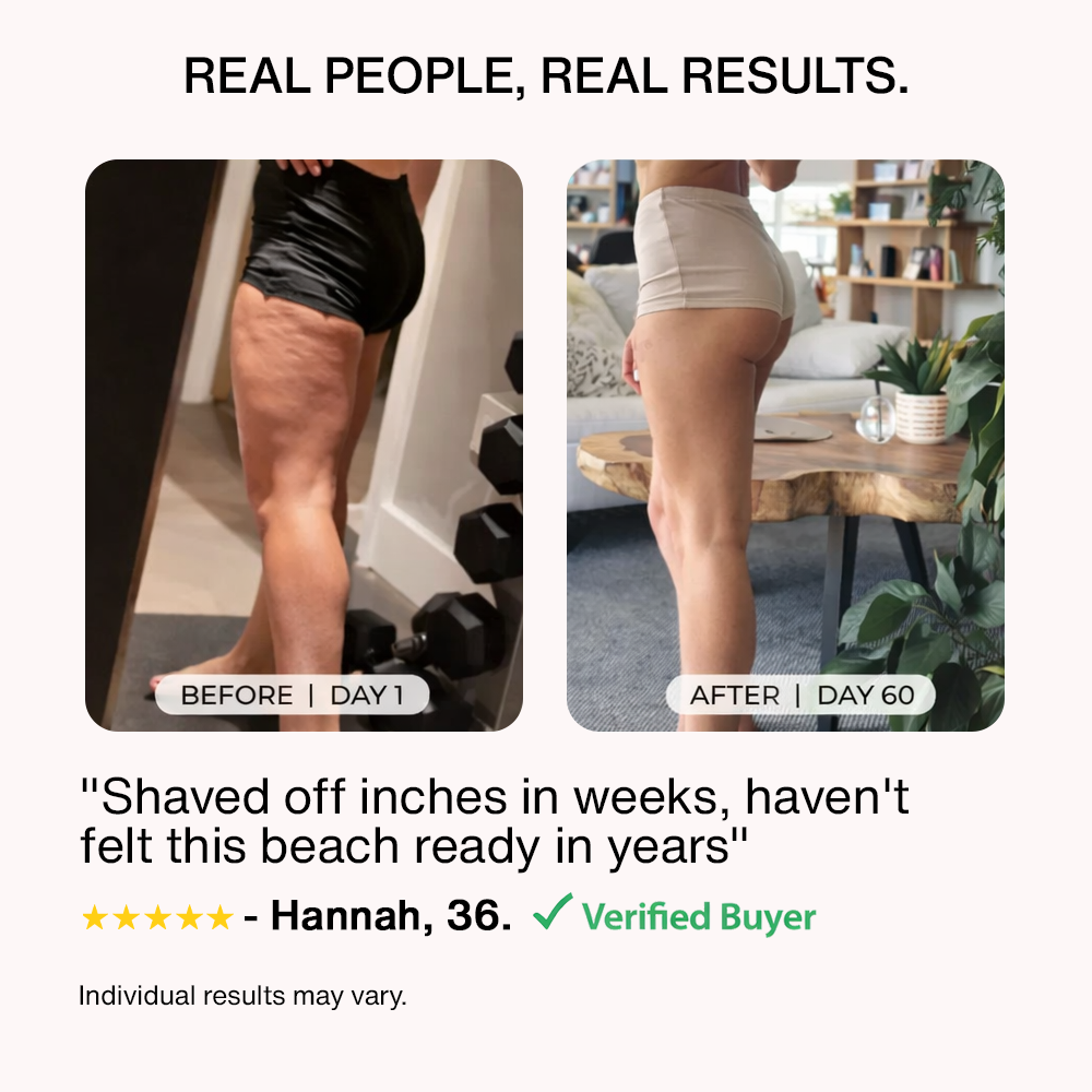 Nutrofuels™ Contour Band – Sculpt Arms & Thighs, Smooth Cellulite, Firm Skin