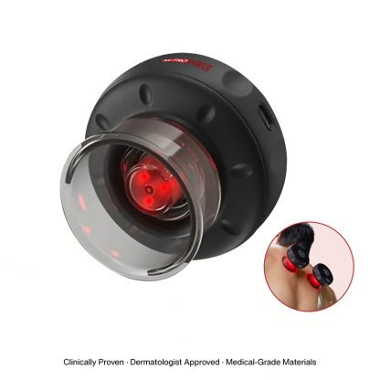Nutrofuels™ 3-in-1 Cupping Massager – Suction, Heat & Red Light for Deep Muscle Relief