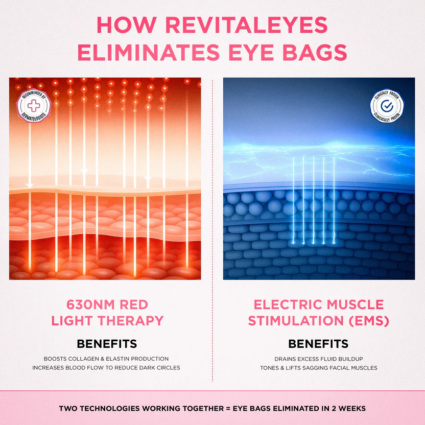 RevitalEyes® 2-in-1 Red Light Therapy + EMS To Erase Eye Bags