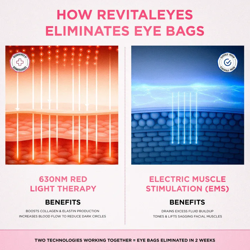 RevitalEyes® 2-in-1 Red Light Therapy + EMS To Erase Eye Bags