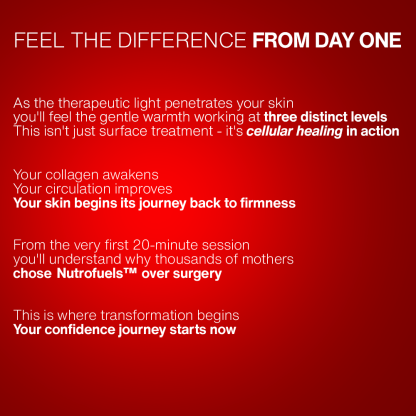 Nutrofuels™ Red Light Belt for Loose Postpartum Belly Skin & Stretch Marks