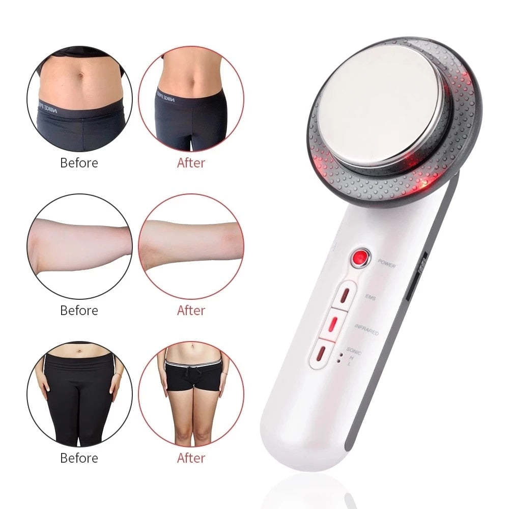 Nutrofuels™ UltraSculpt Cavitation – At-Home Fat & Cellulite Reduction