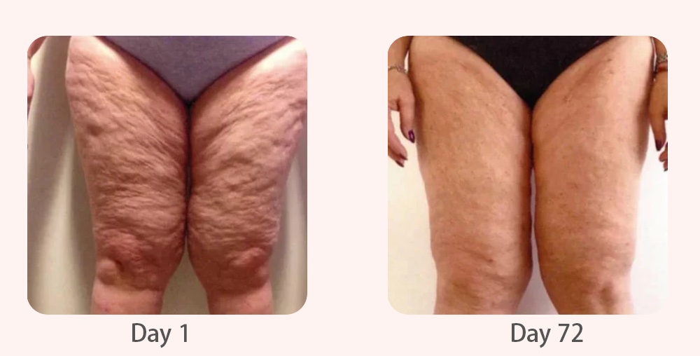 Shauna relaxing while using the sculpting band