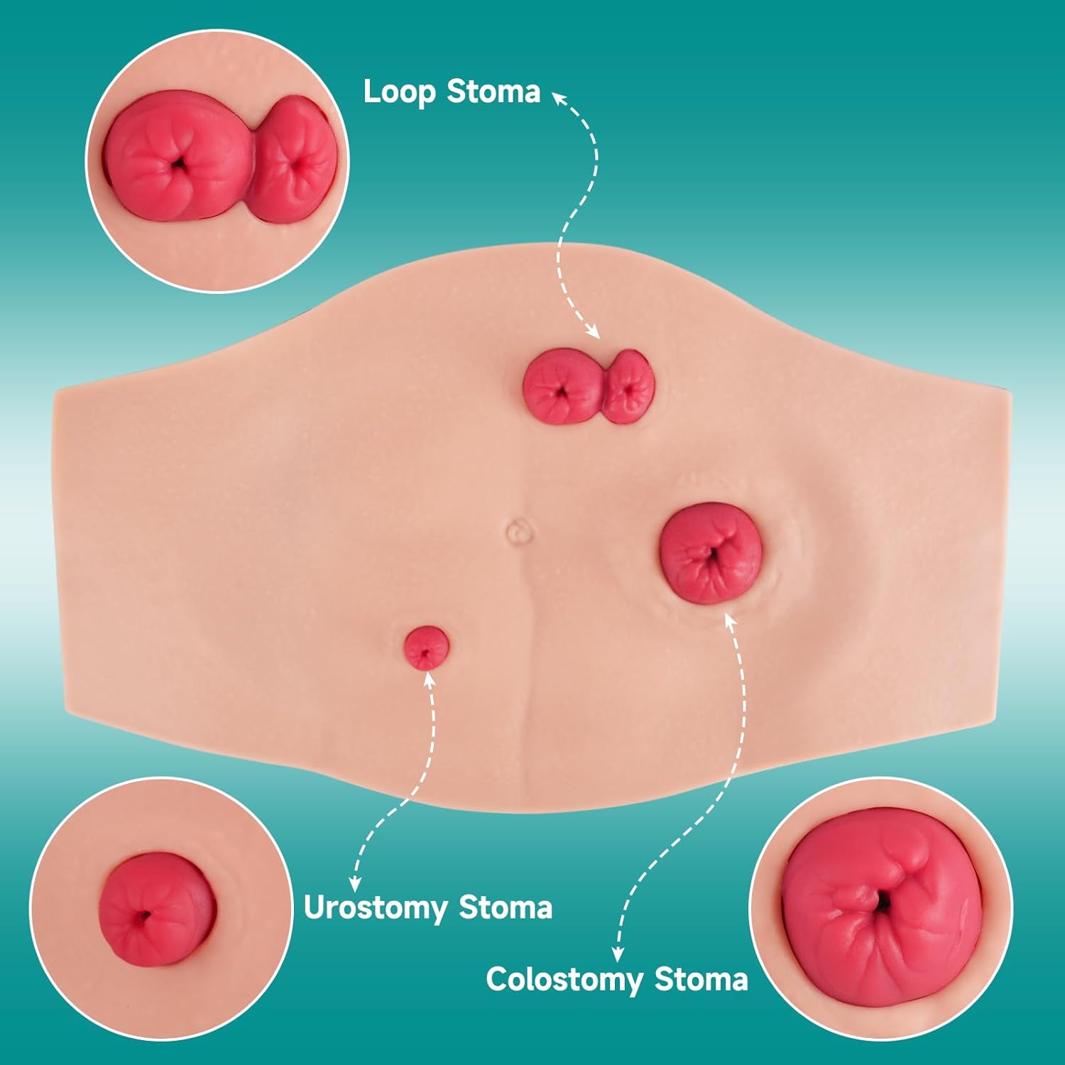 Wearable Belly Ostomy Care Trainer Kit with Simulated Excretion