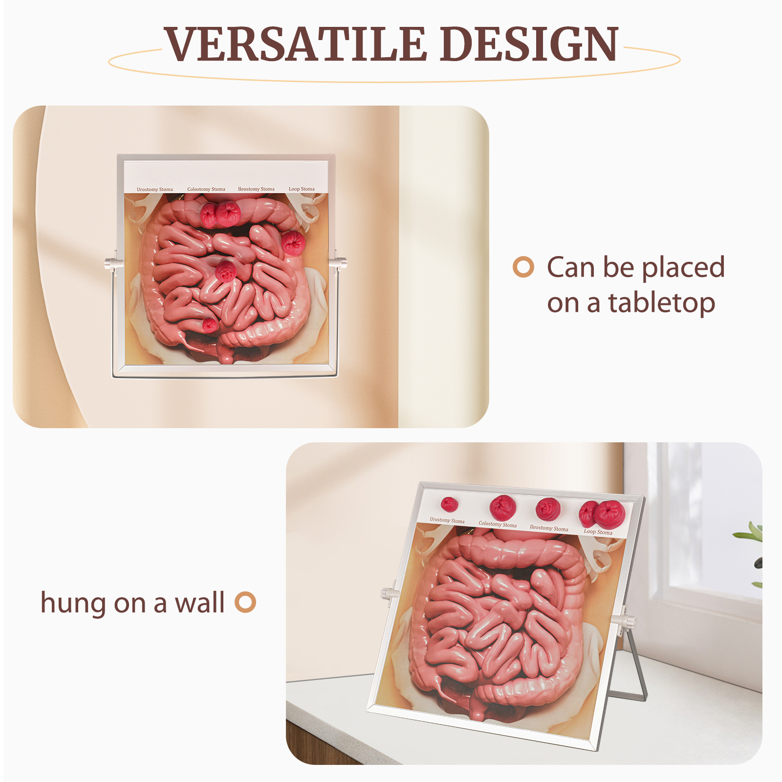 Ostomy Model Kit for Stoma Care Teaching