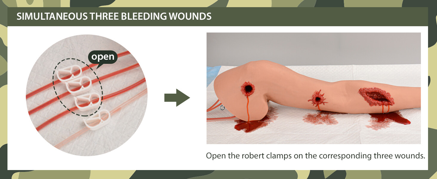Wearable Hemorrhage Control Arm with Simultaneous Three Bleeding Wounds