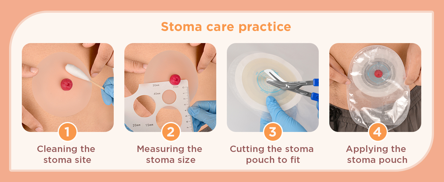 Sticky Urostomy Care Training Kit