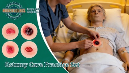 Sticky Stoma Complications Simulation Models Set