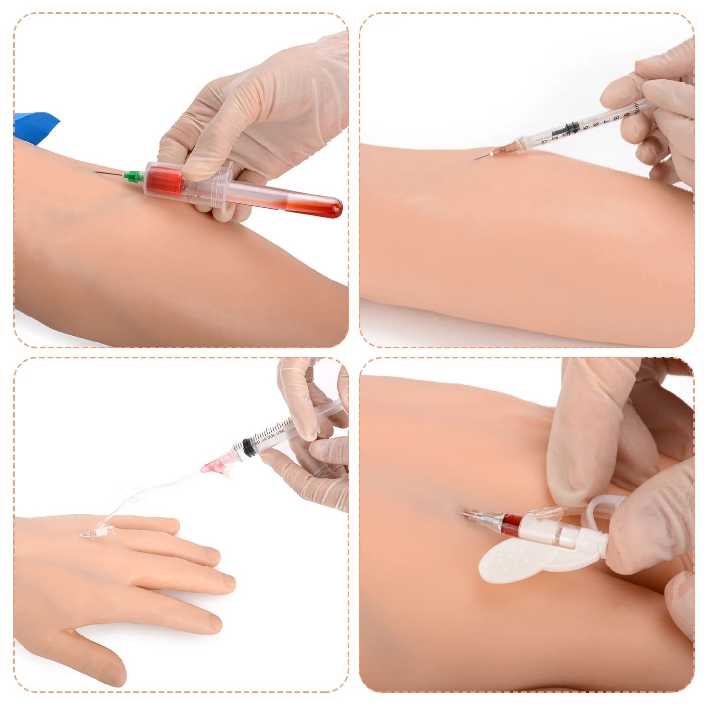 IV Injection Arm for Phlebotomy Venipuncture Cannulation Practice