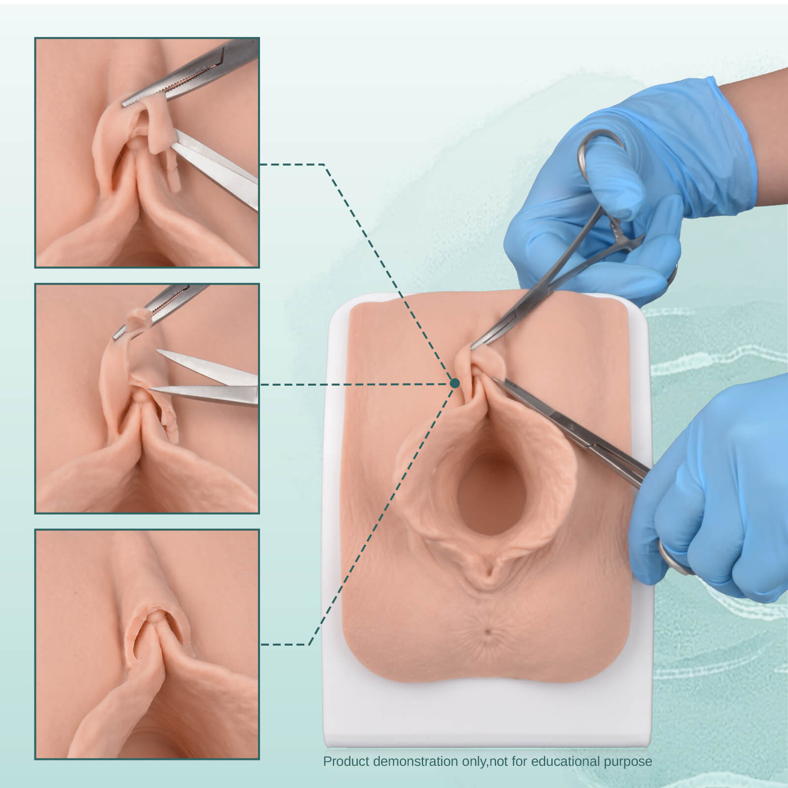 labia repair model for aesthetic gynecology surgical training