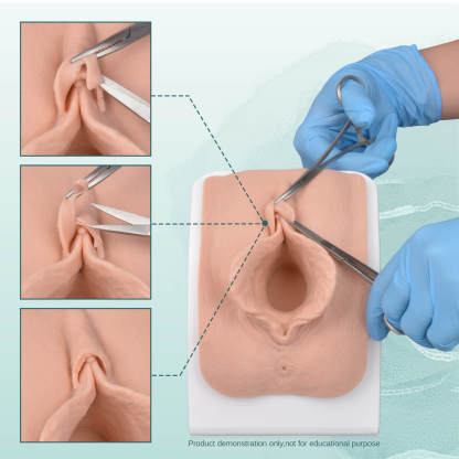 labia repair model for aesthetic gynecology surgical training