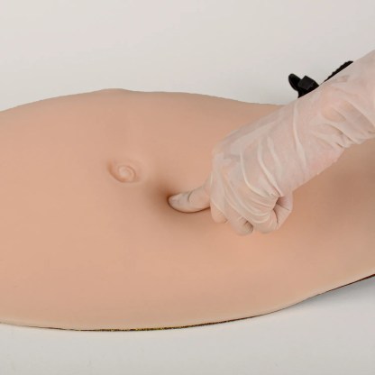 Abdominal Subcutaneous Injection Training Kit