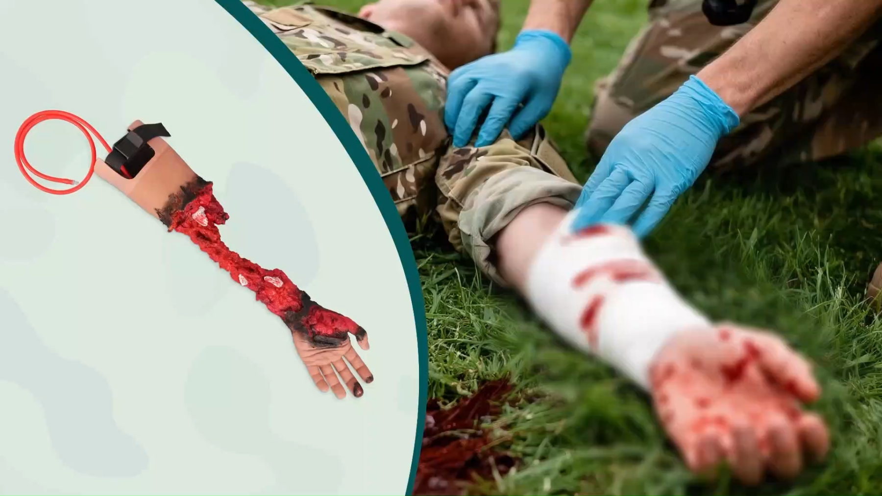 Partial Arm Amputation Trauma Trainer, Left