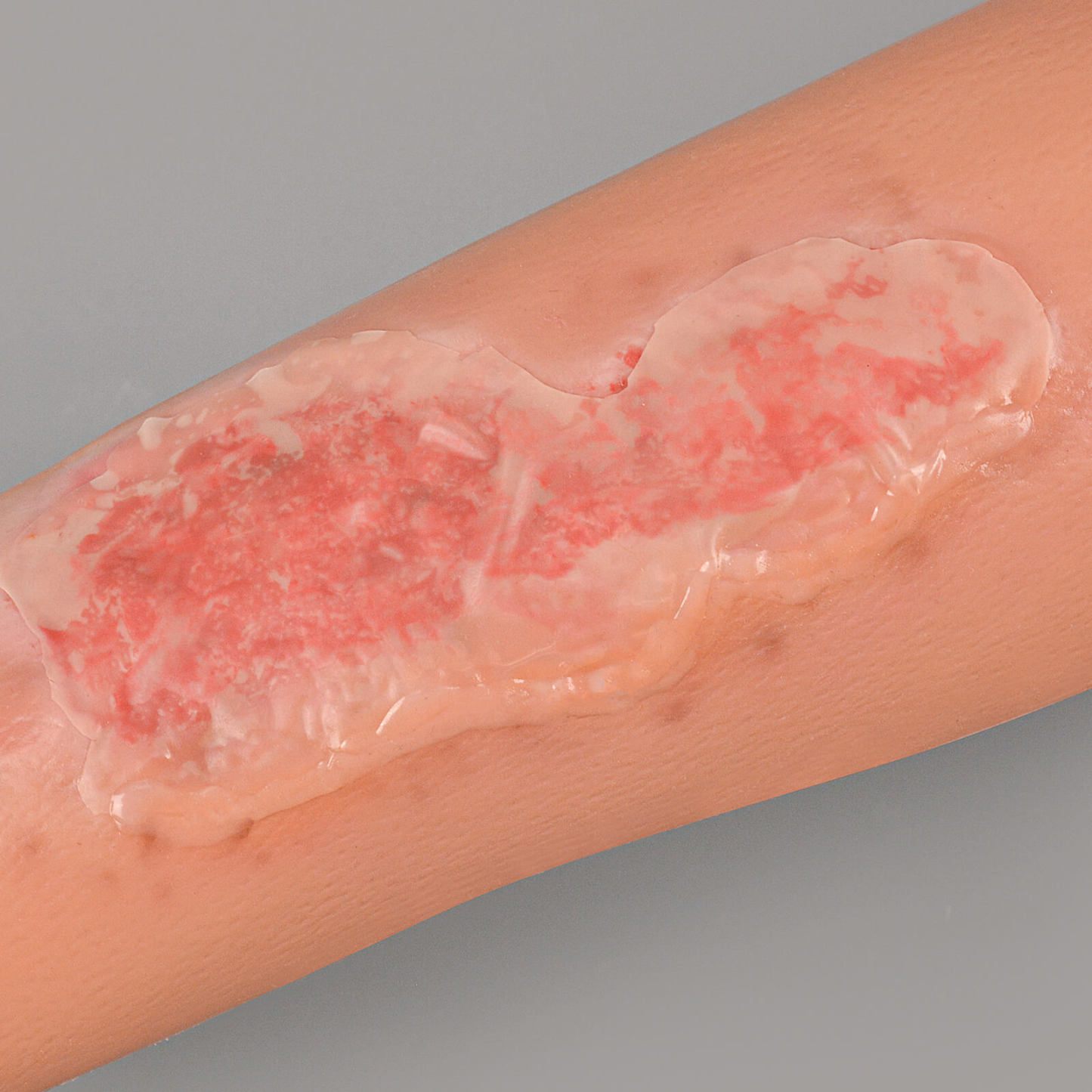 Abrasion Wound Care Simulation Sleeve